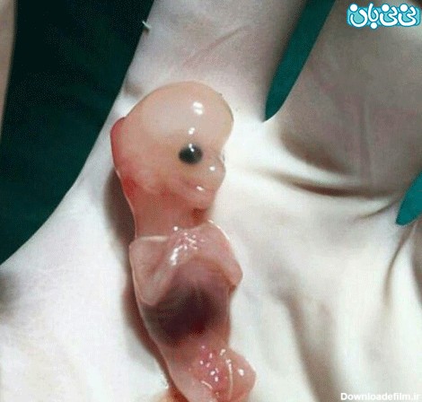 جنین سقط شده، تصویری باور نکردنی