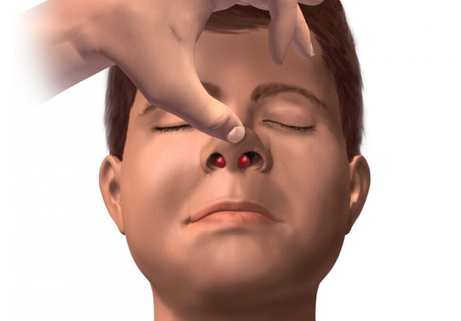 بلافاصله پس از بروز زخم در داخل بینی به پزشک مراجعه کنید - سلامت نیوز