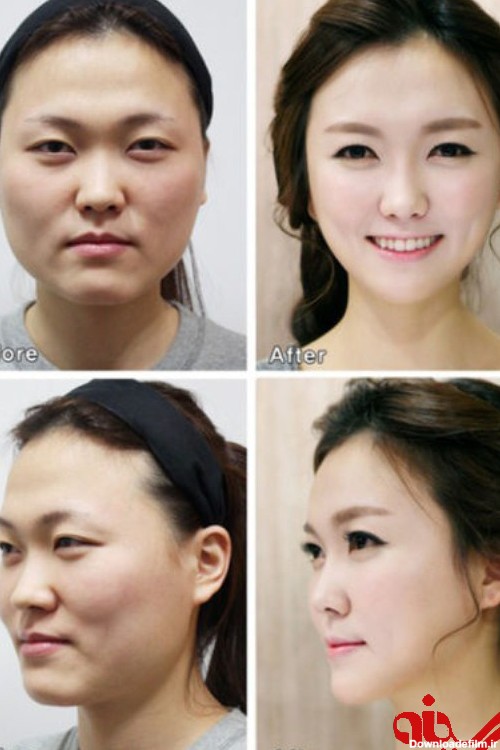 جراحی زیبایی با صورت زنان چه می کند؟!+تصاویر