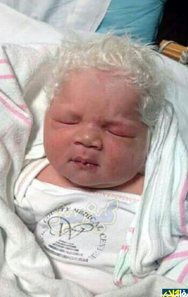 شفا آنلاین - نوزاد زال آفریقایی با موهای سفید+عکس - صاحب‌خبر