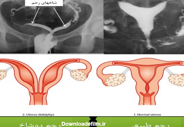 نظرات راجع به عکس رنگی رحم