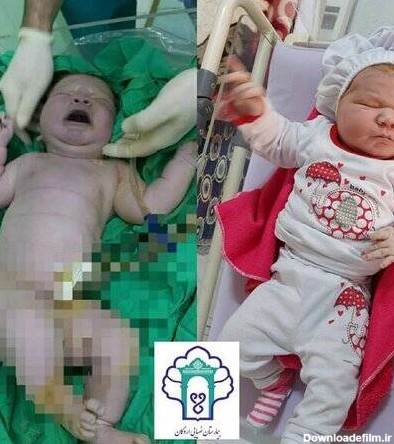 تولد نوزاد ۶ کیلویی در ایران +عکس - مشرق نیوز