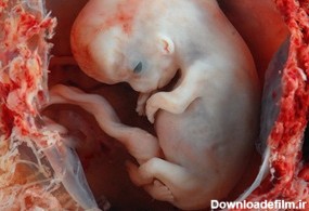 چگونه می‌توان قانونی سقط جنین کرد؟ | مجله نی نی سایت