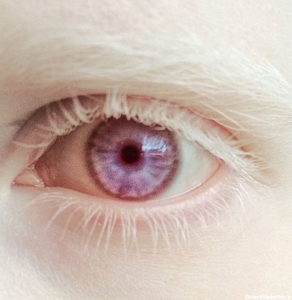 چرا رنگ چشم برخی بنفش است؟/ نادرترین رنگ چشم در جهان چیست ...
