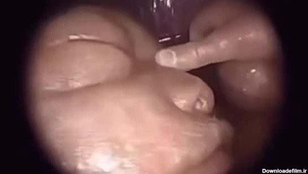 تصویر واقعی بچه در شکم مادر - نماشا