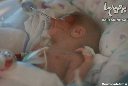 تصاویری از تولد نوزاد نیم کیلویی در امارات!