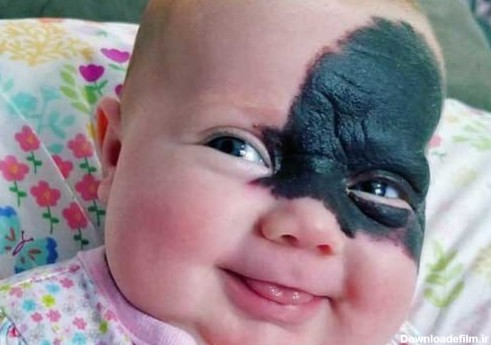 زیبایی این نوزاد عجیب الخلقه همه را شوکه کرد+ تصویر