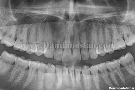 رادیولوژی دندان – دندانستان ، اطلاعات جامع دندانپزشکی