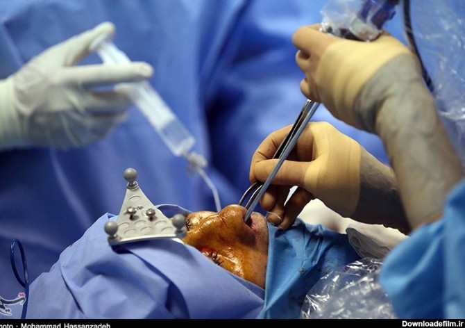 عمل جراحی برداشتن تومور هیپوفیز- عکس خبری تسنیم | Tasnim