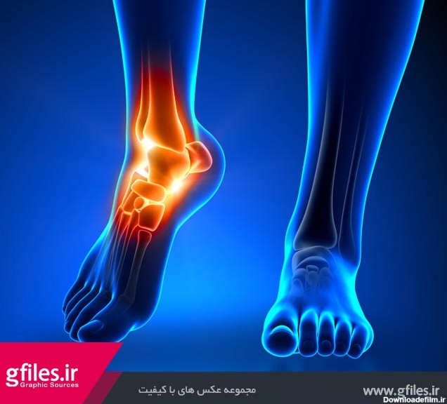 عکس با کیفیت درد مچ پا (Ankle pain)