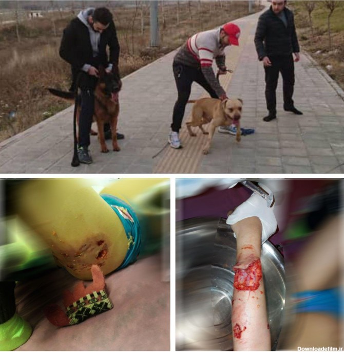 حمله وحشیانه سگ‌ها به دختربچه در پارک لواسان +عکس