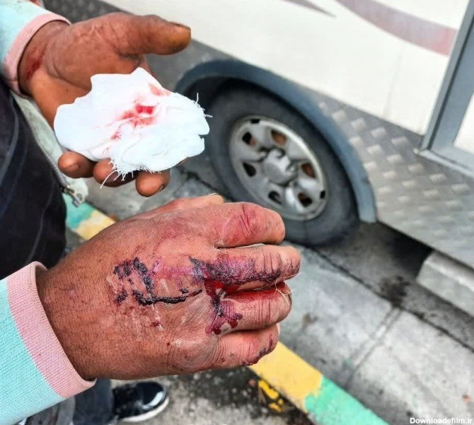 تصاویر هولناک حمله سگ‌های ولگرد به یک خانواده در فردیس | سگ‌ها خون به پا کردند!