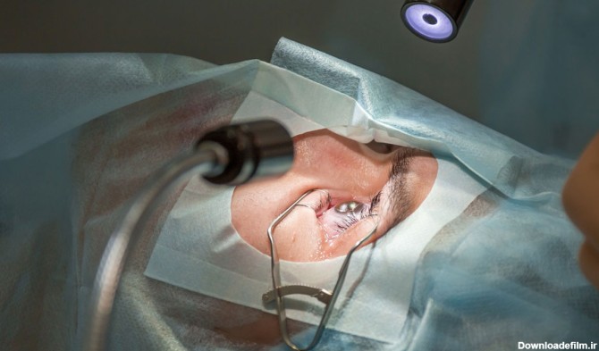 جراحی لیزیک چشم چیست؛ همه چیز درمورد عمل لیزیک | مجله دکتردکتر