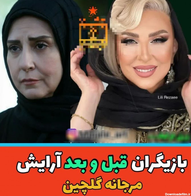 عکس های شوکه کننده بازیگران زن ایرانی قبل و بعد از آرایش
