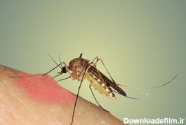 درمان های خانگی برای گزیدگی حشرات - مشرق نیوز