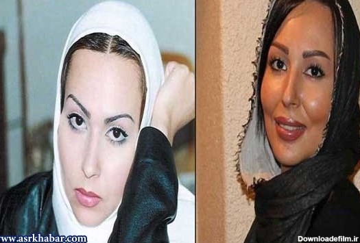 تفاوت چهره بازیگران زن ایرانی، قبل و بعد از عمل زیبایی (عکس)
