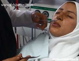 درمان جای بخیه های جراحی بینی - دکتر حمیدرضا حسنانی