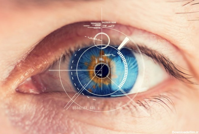 انواع عمل چشم | آشنایی با انواع عمل چشم برای رفع عیوب و زیبایی چشم