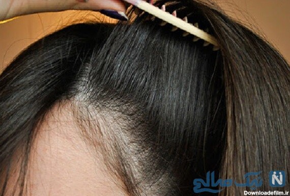 پرپشت شدن مو | روش های طبیعی برای پرپشت کردن موها را بدانید