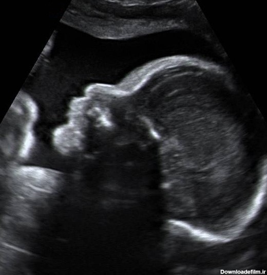 عکس جنین در هفته بیست و هفتم بارداری تصویر و اندازه جنین | نی نی پلاس
