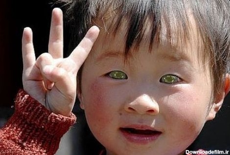 آخرین خبر | عکس/ پسر چینی با چشمان بسیار عجیب