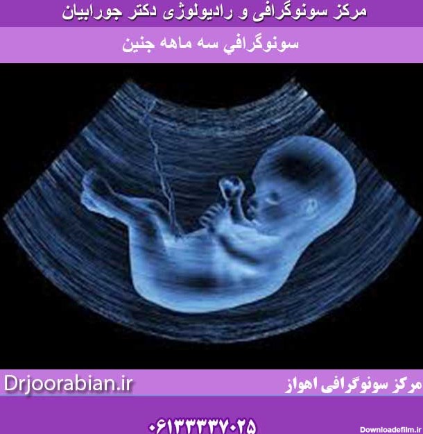 سونوگرافی بررسی رشد جنین در ٣ ماهه سوم | بررسی رشد جنین در ٣ ماهه سوم