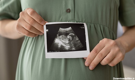 جنین یک ماهه و تمام نکات مهم در ماه اول بارداری