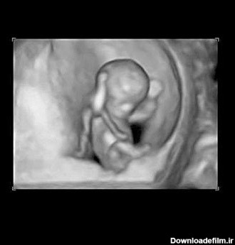 عکس جنین در هفته یازدهم بارداری تصویر و اندازه جنین | نی نی پلاس