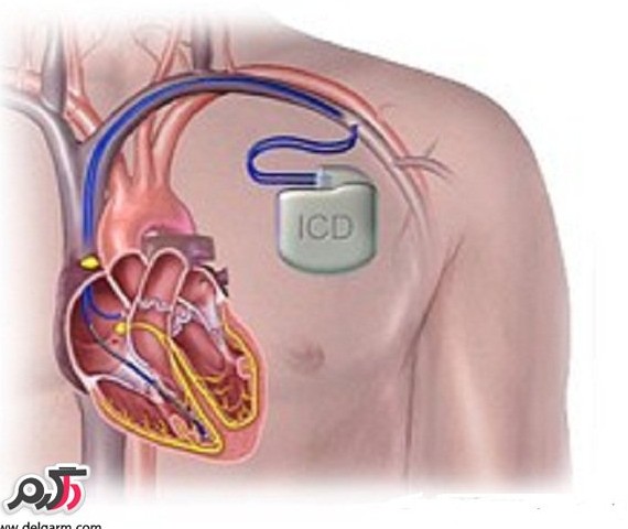 عکس باتری قلب انسان