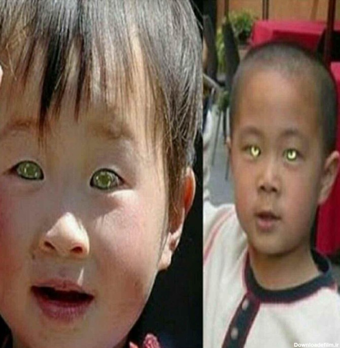 پسر بچه چینی که با چشمان آبی روشن متولد شده است، قادر است - عکس ویسگون