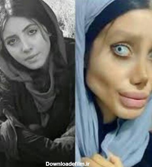 عکس های عروس مردگان ایرانی قبل از عمل جراحی