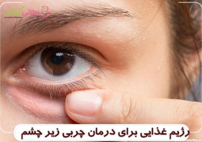دانه های زیر چشم و درمان 100% آن (میلیا)
