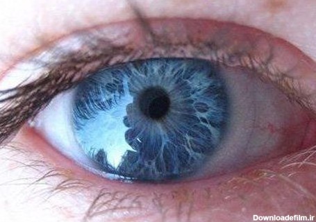 علت آبی شدن رنگ چشم چیست؟+عکس