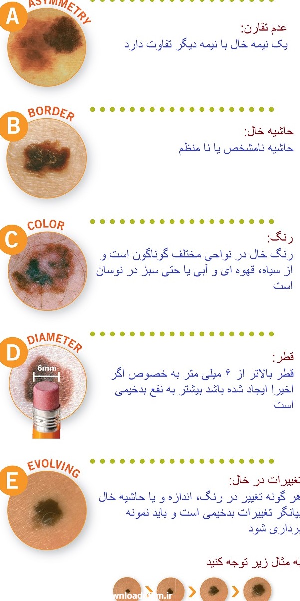 تصاویر خال های سرطانی