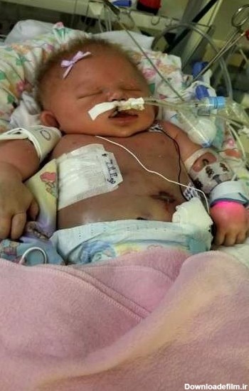بوسیدن نوزاد تازه متولد شده او را به کشتن داد+عکس - منیبان