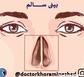 تفاوت بین انحراف بینی و کجی بینی - دکتر سامان خرمی نژاد