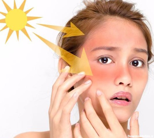 ضد آفتاب چیست؟ معرفی انواع ضد آفتاب ها و معایت و مزایای آنها