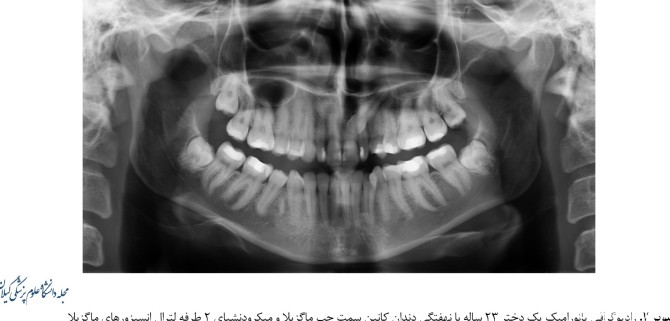ارزیابی فراوانی و نوع آنومالی‌های دندانی در تصاویر رادیوگرافی ...