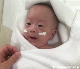 تولد کوچک ترین و ریز ترین نوزاد دنیا + تصاویر شگفت انگیز