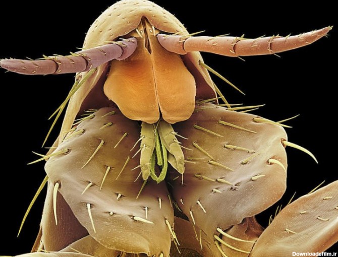 تصویر میکروسکوپی از کک انسان (Human flea (Pulex irritans – زیستمن ...