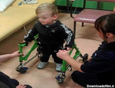 کودک دوساله مبتلا به فلج مغزی سرانجام روی پای خود ایستاد + تصاویر