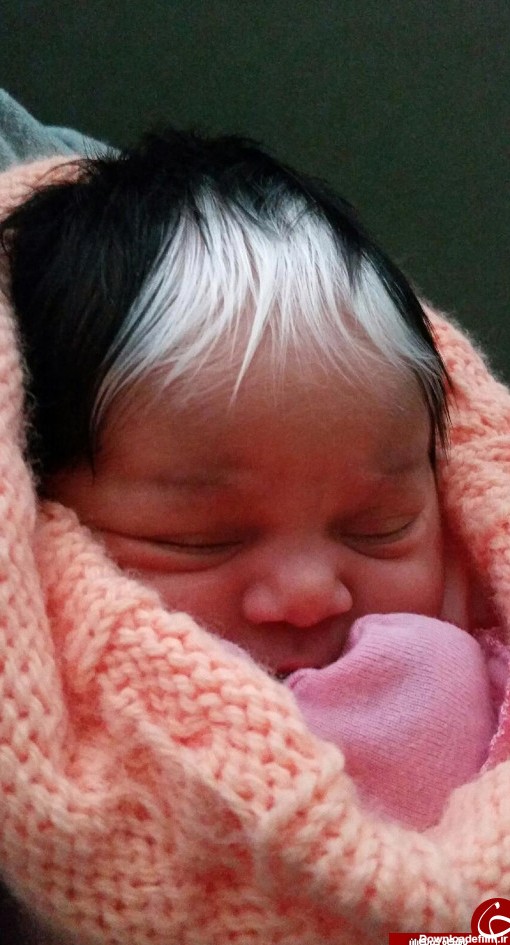 این نوزاد با موهای سفید بدنیا آمد+ تصاویر