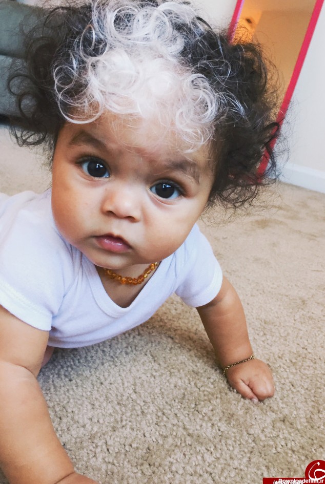 این نوزاد با موهای سفید بدنیا آمد+ تصاویر