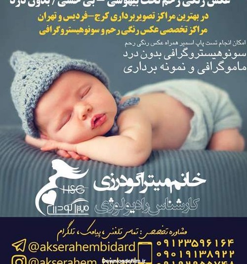 عکس رنگی کلیه مثانه نوزاد و اطفال در کرج و تهران و فردیس و شهریار ...