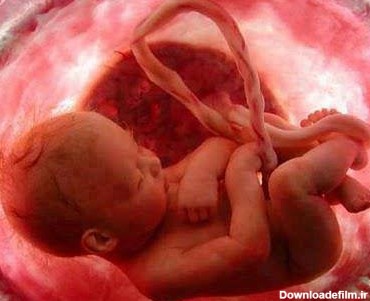 جنین مرده در شکم مادر/ وقتی که قلب جنین می ایستد/علائم سقط جنین