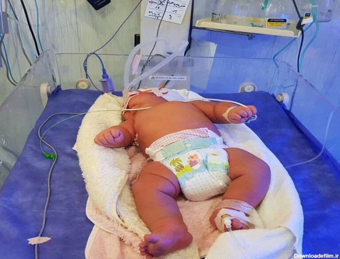 سنگین وزن ترین نوزاد ایران متولد شد +عکس - مشرق نیوز