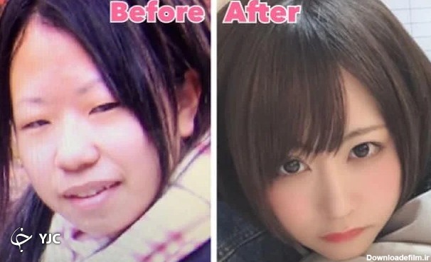 حیرت کاربران از تغییر چهره دختر ژاپنی پس از جراحی پلاستیک!