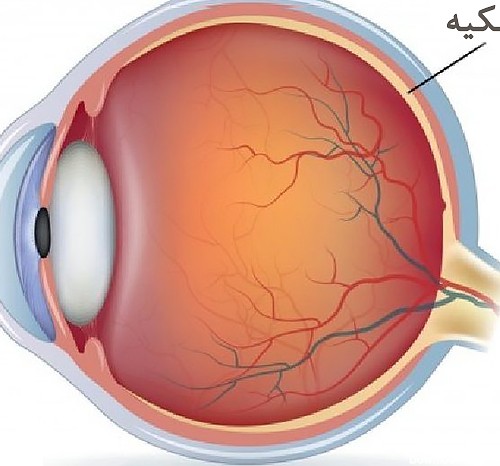 Retinal بیماری های شبکیه چشم