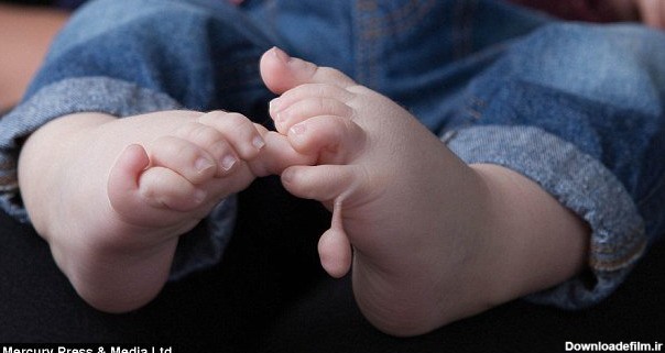 این نوزاد ۱۲ انگشت دست و پا دارد - خبرگزاری مهر | اخبار ...