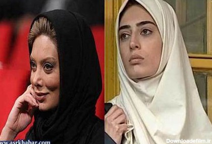 عکس: بازیگران زن ایرانی، قبل و بعد از عمل